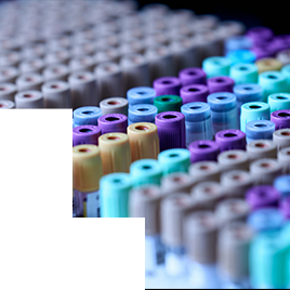 Test tubes in a rack - Health.